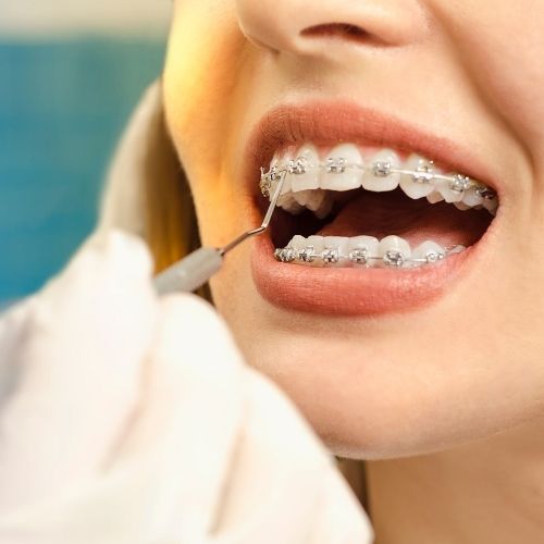 Restorative Dentistry